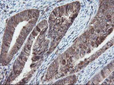 Immunohistochemistry-Paraffin: SnoN Antibody (OTI3E2) [NBP2-03881]