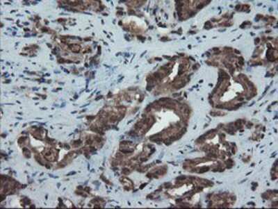 Immunohistochemistry-Paraffin: SnoN Antibody (OTI3E2) [NBP2-03881]