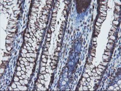 Immunohistochemistry-Paraffin: SnoN Antibody (OTI3E2) [NBP2-03881]