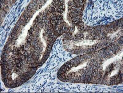 Immunohistochemistry: SnoN Antibody (OTI3F6) [NBP2-45851]