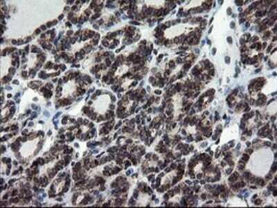 Immunohistochemistry: SnoN Antibody (OTI3F6) [NBP2-45851]
