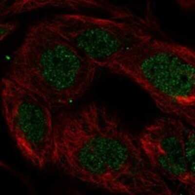 Immunocytochemistry/ Immunofluorescence: SnoN Antibody [NBP3-17793]