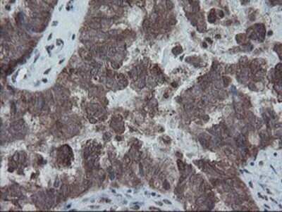 Immunohistochemistry: SnoN Antibody (OTI3E2) - Azide and BSA Free [NBP2-74255]