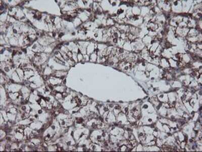 Immunohistochemistry: SnoN Antibody (OTI3E2) - Azide and BSA Free [NBP2-74255]