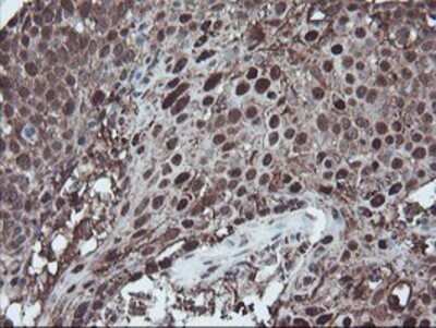 Immunohistochemistry: SnoN Antibody (OTI3E2) - Azide and BSA Free [NBP2-74255]