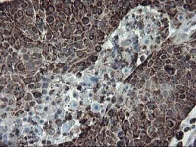 Immunohistochemistry: SnoN Antibody (OTI3F6) - Azide and BSA Free [NBP2-74254]
