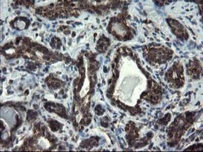 Immunohistochemistry: SnoN Antibody (OTI3F6) - Azide and BSA Free [NBP2-74254]