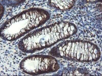 Immunohistochemistry: SnoN Antibody (OTI3F6) - Azide and BSA Free [NBP2-74254]