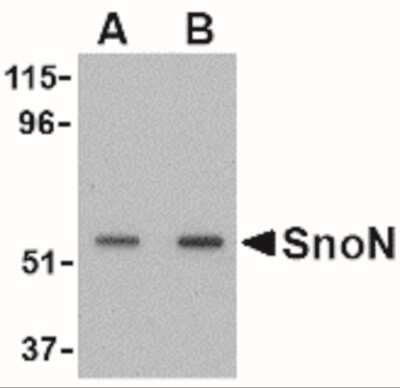 Western Blot: SnoN AntibodyBSA Free [NBP1-77306]