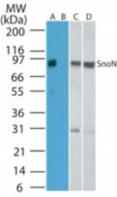 Western Blot: SnoN Antibody [NBP2-24718]
