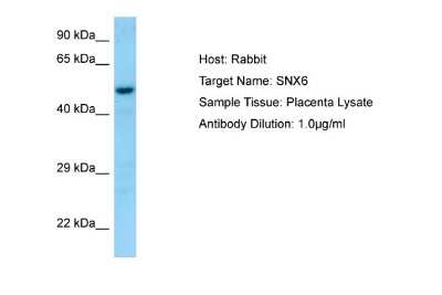Western Blot: Snx6 Antibody [NBP1-98504]