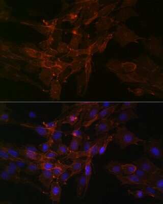 Immunocytochemistry/ Immunofluorescence: Sodium Potassium ATPase Alpha 1 Antibody (3L6F0) [NBP3-15427]