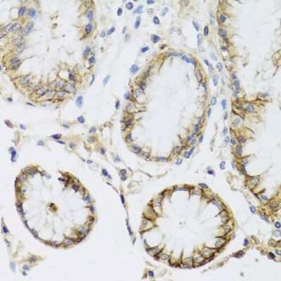 Immunohistochemistry-Paraffin: Sodium Potassium ATPase Alpha 1 Antibody - BSA Free [NBP2-95089]