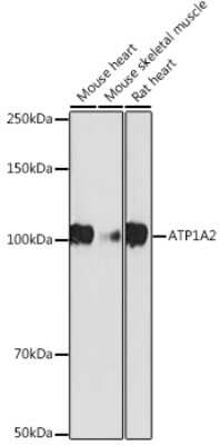 Western Blot: Sodium Potassium ATPase Alpha 2 Antibody (5T3O4) [NBP3-15737]