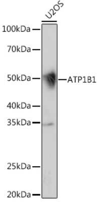 Western Blot: Sodium Potassium ATPase Beta 1 Antibody (4M5T3) [NBP3-16560]