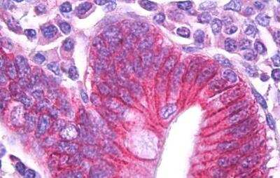 Immunohistochemistry-Paraffin: Sodium Potassium ATPase Beta 1 Antibody [NBP1-51987]