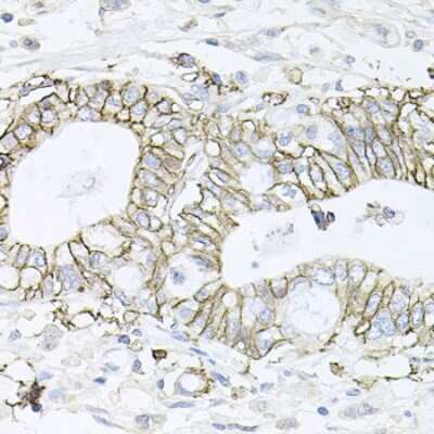 Immunohistochemistry-Paraffin: Sodium Potassium ATPase Beta 1 Antibody - BSA Free [NBP2-95093]