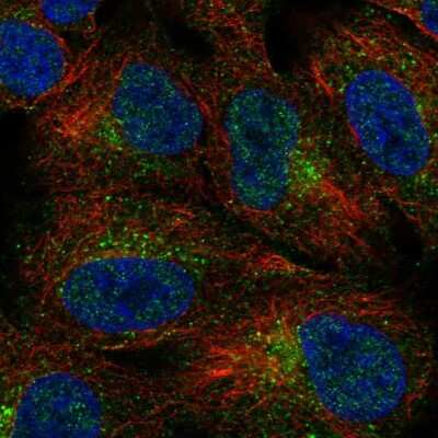 Immunocytochemistry/ Immunofluorescence: Soggy-1/DkkL1 Antibody [NBP2-48868]