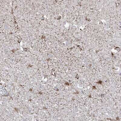 Immunohistochemistry-Paraffin: ARHGEF40 Antibody [NBP1-83864]