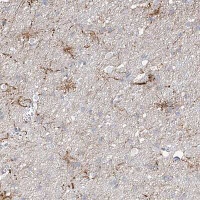 Immunohistochemistry-Paraffin: ARHGEF40 Antibody [NBP1-83865]