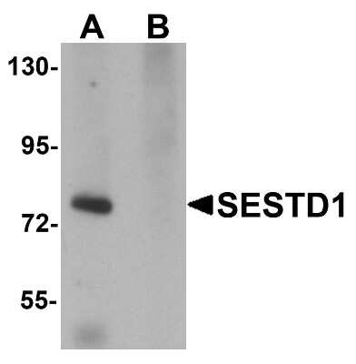 Western Blot: Solo AntibodyBSA Free [NBP1-76279]