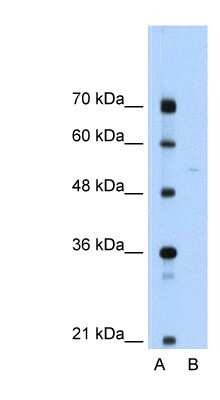 Western Blot: Soluble Liver/Pancreas Antigen Antibody [NBP1-57253]