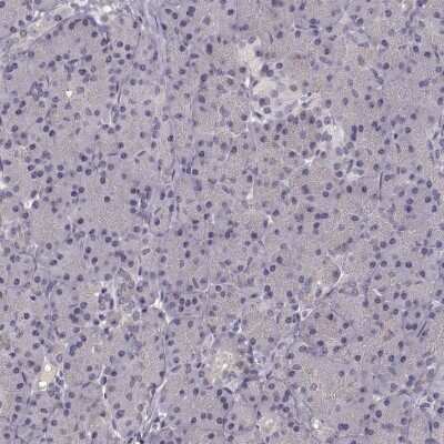 Immunohistochemistry-Paraffin: Solute carrier family 22 member 18 Antibody [NBP2-56316]