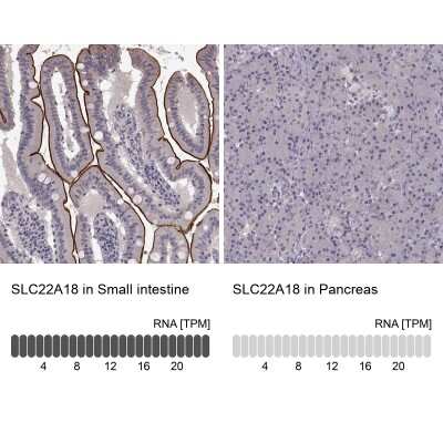 Immunohistochemistry-Paraffin: Solute carrier family 22 member 18 Antibody [NBP2-56316]