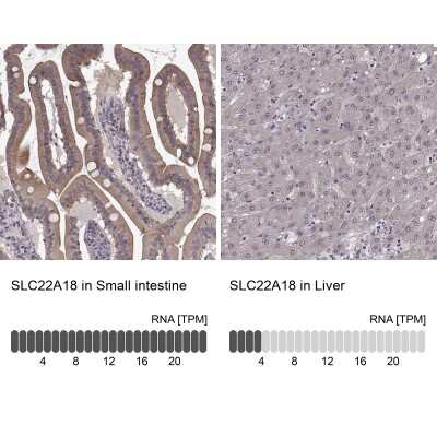Immunohistochemistry-Paraffin: Solute carrier family 22 member 18 Antibody [NBP2-57503]