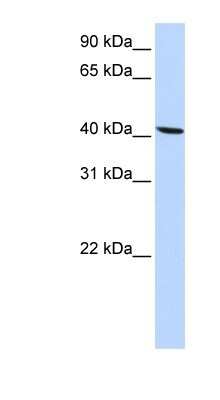 Western Blot: Solute carrier family 22 member 18 Antibody [NBP1-59747]
