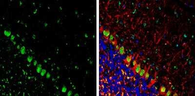 Immunohistochemistry-Frozen: Somatostatin Antibody [NBP3-13160]