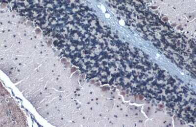 Immunohistochemistry-Paraffin: Somatostatin Antibody [NBP3-13160]