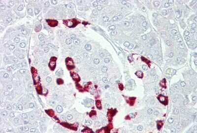 Immunohistochemistry: Somatostatin R1/SSTR1 Antibody [NBP2-88331]