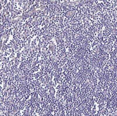 Immunohistochemistry-Paraffin: Somatostatin R1/SSTR1 Antibody [NBP2-34203]