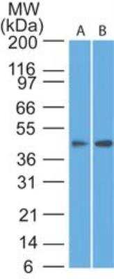 Western Blot: Somatostatin R1/SSTR1 Antibody [NBP2-27413]