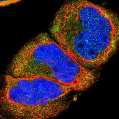 Immunocytochemistry/ Immunofluorescence: Somatostatin R2/SSTR2 Antibody [NBP2-48508]