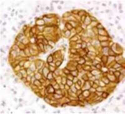 Immunohistochemistry-Paraffin: Somatostatin R2/SSTR2 Antibody [NB100-74537]