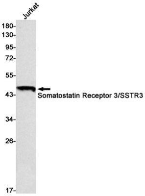Western Blot: Somatostatin R3/SSTR3 Antibody (S08-2G8) [NBP3-19777]
