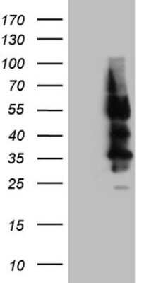 Western Blot: Somatostatin R4/SSTR4 Antibody (OTI2F11) [NBP2-45431]