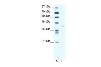 Western Blot: Somatostatin R4/SSTR4 Antibody [NBP2-88334]