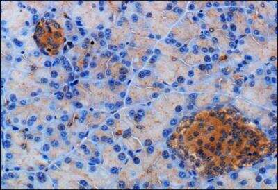 Immunohistochemistry-Paraffin: Somatostatin R2/SSTR2 Antibody [NB300-157]