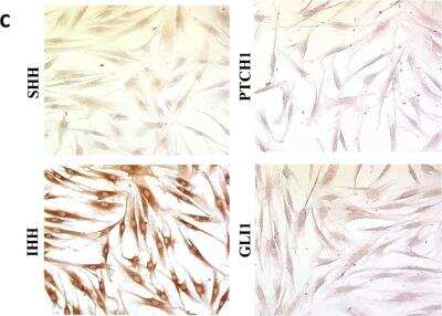 Immunocytochemistry/ Immunofluorescence: Sonic Hedgehog/Shh Antibody (5H4) [NBP2-22126]