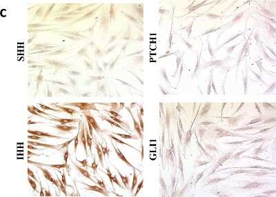 Immunocytochemistry/ Immunofluorescence: Sonic Hedgehog/Shh Antibody (5H4) [NBP2-22126]