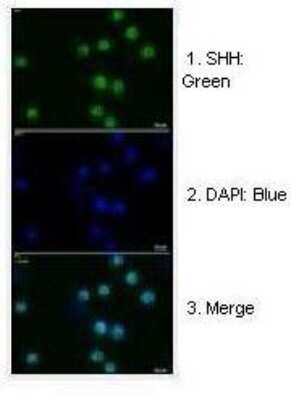 Immunohistochemistry: Sonic Hedgehog/Shh Antibody [NBP1-69270]