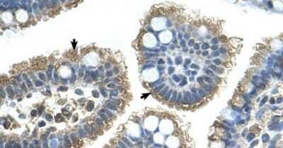 Immunohistochemistry-Paraffin: Sonic Hedgehog/Shh Antibody [NBP1-69270]
