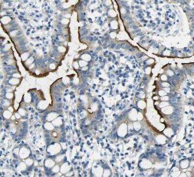 Immunohistochemistry-Paraffin: SorCS1 Antibody [NBP1-86096]