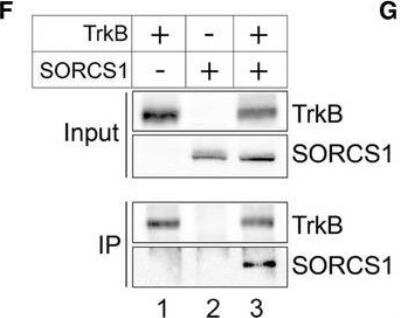 Knockout Validated: SorCS1 Antibody [NBP1-86096]