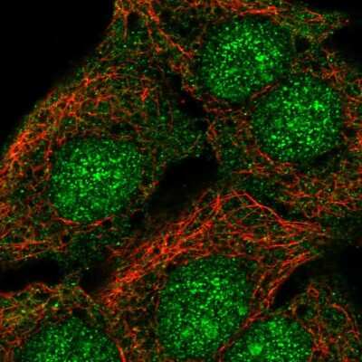Immunocytochemistry/ Immunofluorescence: SorCS2 Antibody [NBP2-56711]