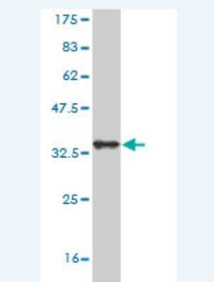 Western Blot: SorCS3 Antibody (3B12) [H00022986-M01]