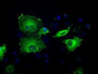Immunocytochemistry/ Immunofluorescence: Sorbitol Dehydrogenase Antibody (OTI9E7) [NBP2-02126]